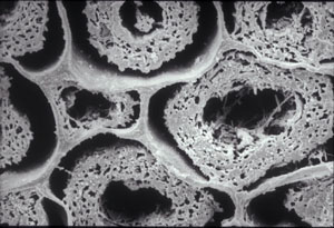 sem bacterial decay inner wood sample